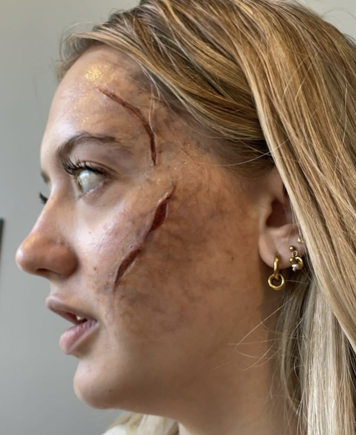 Healed claw-scar trio across the brow and cheek with shimmer highlight