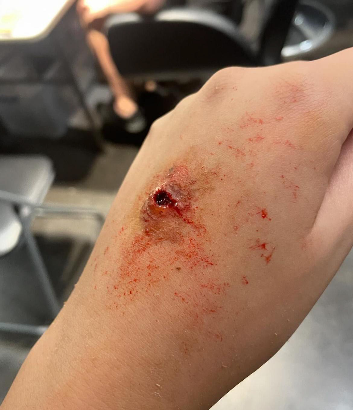 SFX wound — cut detail