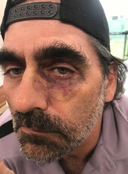SFX injury detail