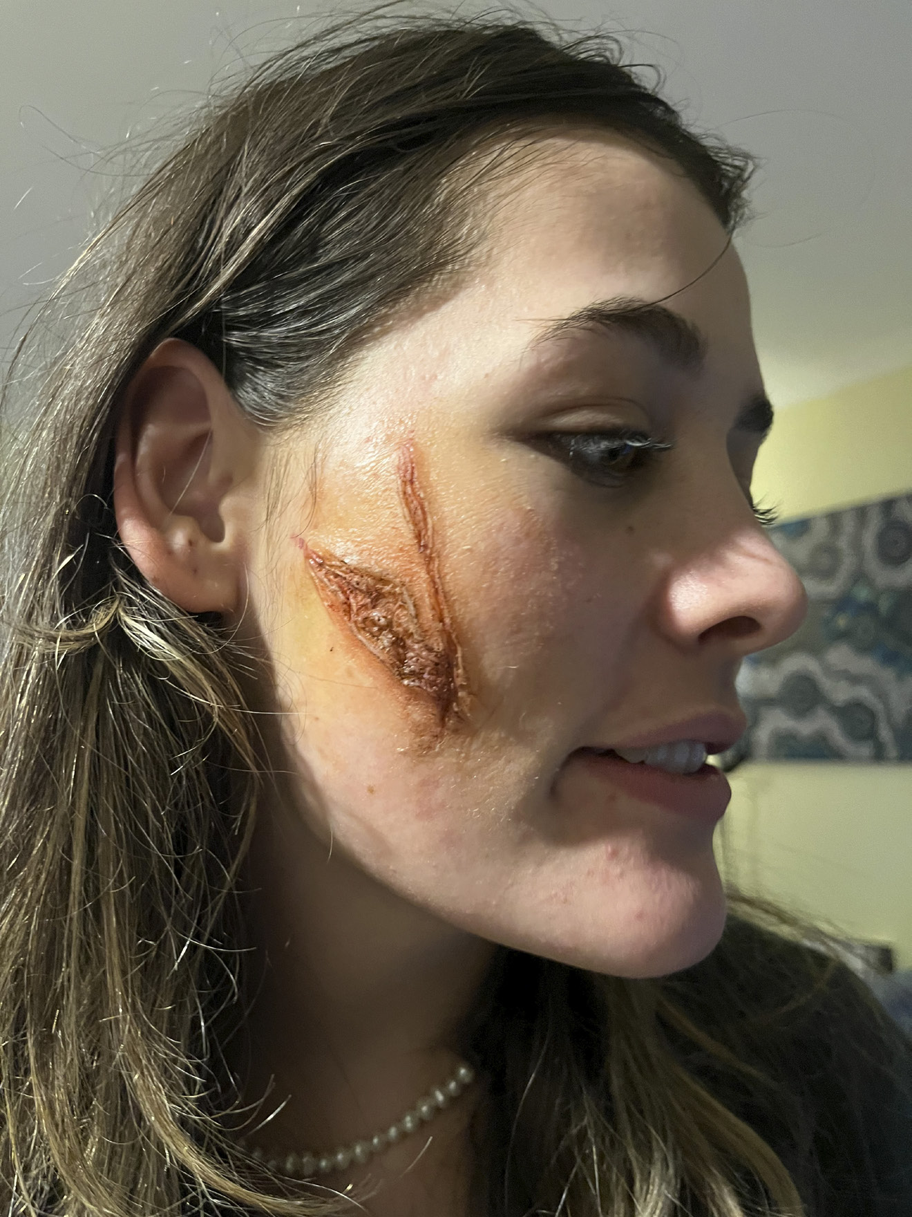 SFX scar detail