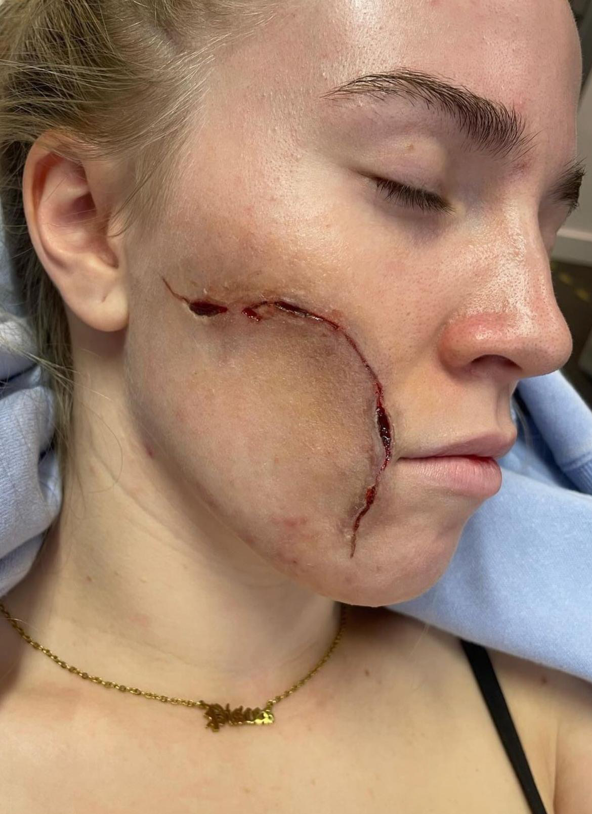 SFX bruise detail